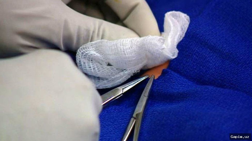 ⚰️🩸 Two Children Die After Circumcision in Uzbekistan: Criminal Case Opened