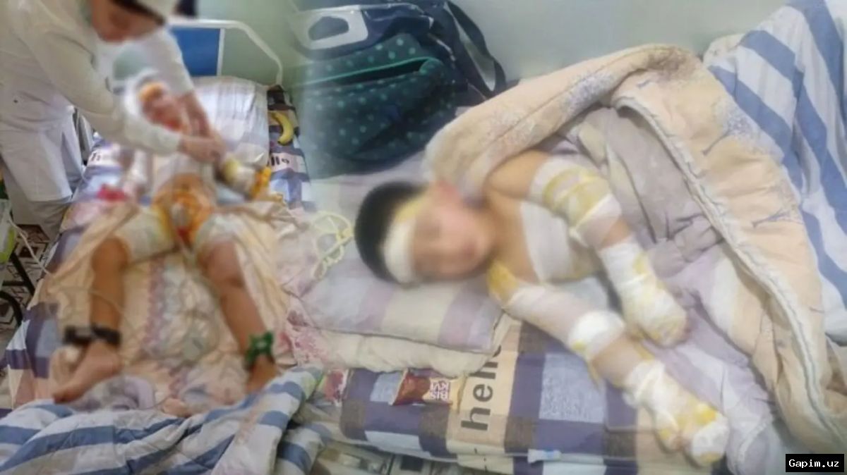 ⚡️👶 4-Year-Old Loses Both Arms After Entering Open Transformer Substation in Uzbekistan
