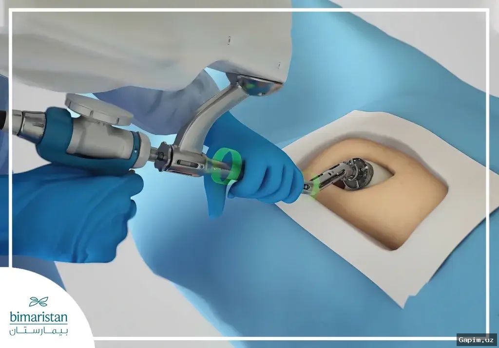🤖🏥 В Самарканде впервые провели операцию на тазобедренном суставе с помощью робота