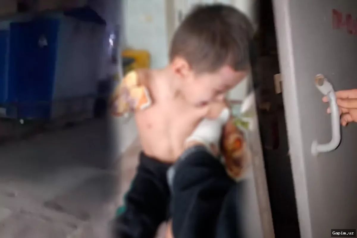 ⚡️👶 В Намангане двухлетний ребенок остался без рук из-за халатности электрика: вынесен приговор
