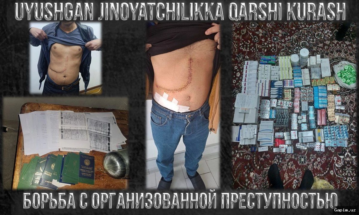 🏥📜 Uzbekistan allows private clinics to perform organ transplants from 2027